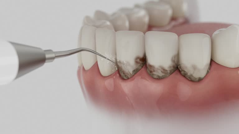 Trusted Emergency Dentist service in Hillsboro, MO - Dentist Open Now